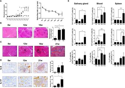 IL-17 and CCR9+α4β7– Th17 Cells Promote Salivary Gland Inflammation, Dysfunction, and Cell Death in Sjögren’s Syndrome